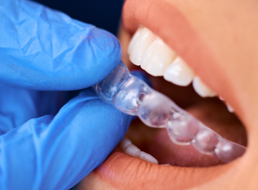 Ortodontia com Invisalign